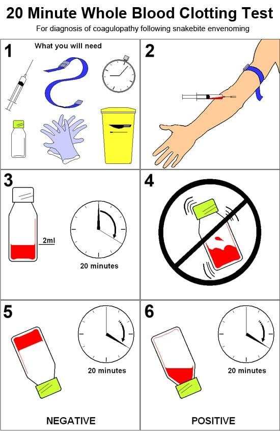 20 min whole blood clotting test